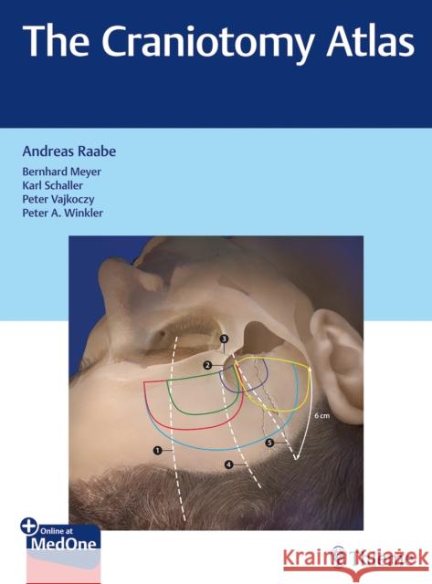 The Craniotomy Atlas Raabe, Andreas 9783132057913
