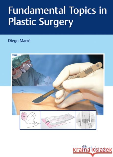 Fundamental Topics in Plastic Surgery Marre, Diego 9783132059115 Tps
