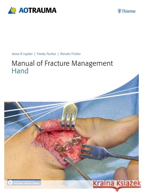 Manual of Fracture Management - Hand Jupiter, Jesse B. 9783132215818 Thieme/Ao