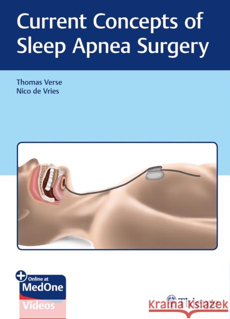 Current Concepts of Sleep Apnea Surgery Filippo Montevecchi Thomas Verse Nico D 9783132401198