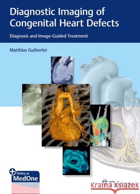 Diagnostic Imaging of Congenital Heart Defects: Diagnosis and Image-Guided Treatment Gutberlet, Matthias 9783132402515