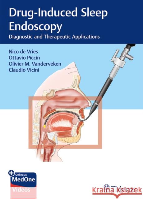 Drug-Induced Sleep Endoscopy: Diagnostic and Therapeutic Applications Nico D Ottavio Piccin Olivier Vanderveken 9783132403468 Thieme Medical Publishers