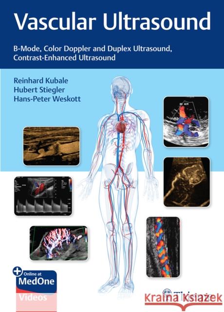 Vascular Ultrasound R Kubale 9783132405431 Thieme Publishing Group