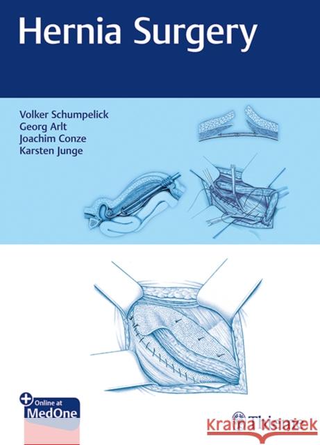 Hernia Surgery Schumpelick, Volker 9783132405516 Thieme Medical Publishers