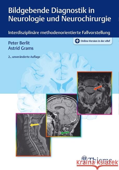 Bildgebende Diagnostik in Neurologie und Neurochirurgie : Interdisziplinäre methodenorientierte Fallvorstellung. Online-Version in der eRef Berlit, Peter; Grams, Astrid 9783132406155 Thieme, Stuttgart