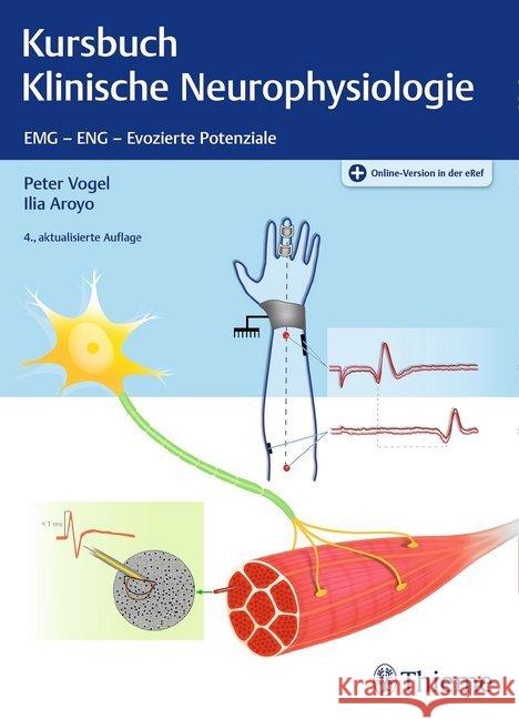 Kursbuch Klinische Neurophysiologie : EMG - ENG - Evozierte Potentiale. Plus Online-Version in der eRef Vogel, Peter; Aroyo, Ilia 9783132411265