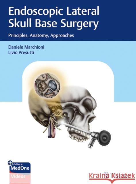 Endoscopic Lateral Skull Base Surgery: Principles, Anatomy, Approaches Daniele Marchioni Livio Presutti 9783132412774 Thieme Medical Publishers