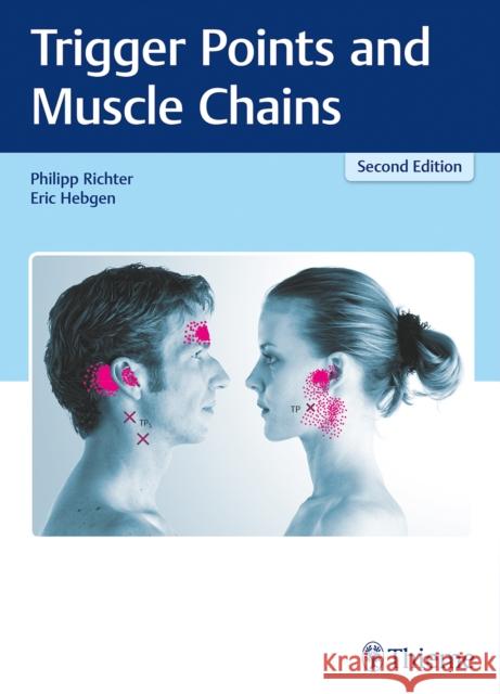 Trigger Points and Muscle Chains Richter, Philipp 9783132413511