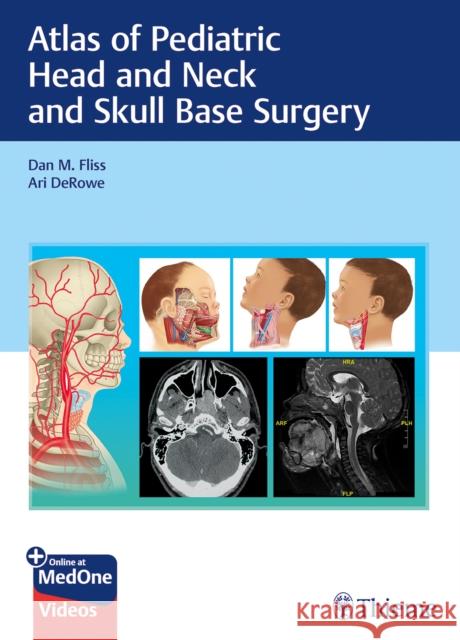 Atlas of Pediatric Head and Neck and Skull Base Surgery Dan M. Fliss Ari Derowe 9783132414273 Thieme Medical Publishers