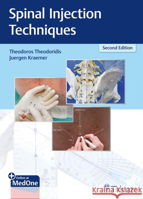 Spinal Injection Techniques Theodoridis, Theodoros 9783132414471 Thieme Medical Publishers