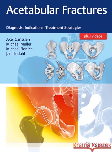 Acetabular Fractures: Diagnosis, Indications, Treatment Strategies Gänsslen, Axel 9783132415607