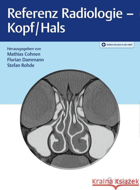 Referenz Radiologie - Kopf/Hals Cohnen, Mathias; Dammann, Florian; Rohde, Stefan 9783132419759 Thieme, Stuttgart