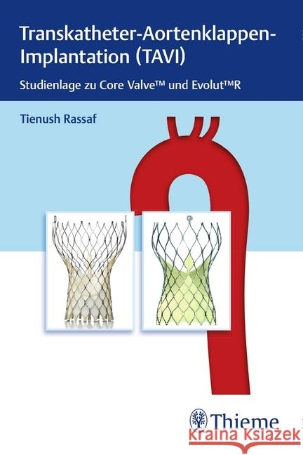 Transkatheter Aortenklappenimplantation (TAVI) : Studienlage zu CoreValve und Evolut R.  9783132420144 Thieme