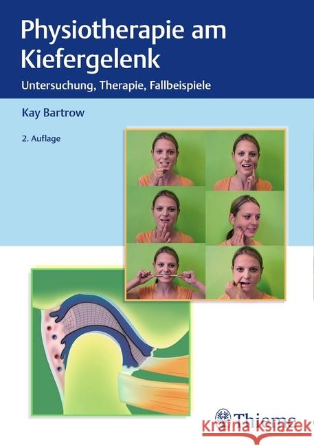 Physiotherapie am Kiefergelenk : Untersuchung, Therapie, Fallbeispiele Bartrow, Kay 9783132420267 Thieme, Stuttgart