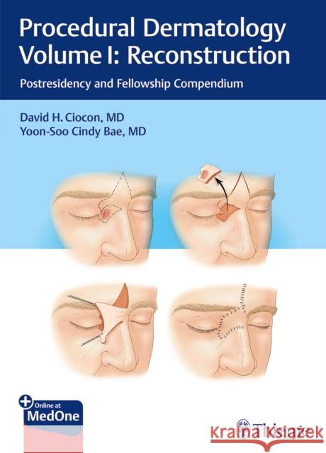 Procedural DermatologyVolume I: Reconstruction D Ciocon 9783132424050 Thieme Publishing Group