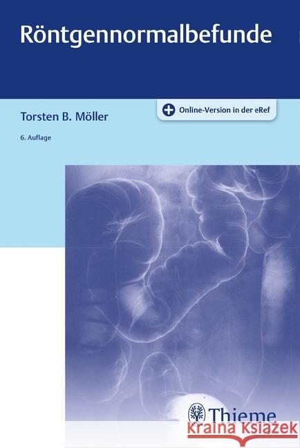 Röntgennormalbefunde : Plus Online-Version in der eRef Möller, Torsten B. 9783132428287