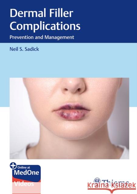 Dermal Filler Complications: Prevention and Management  9783132428492 Thieme Publishing Group