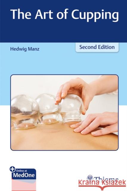 The Art of Cupping Manz, Hedwig 9783132431720 Thieme Medical Publishers