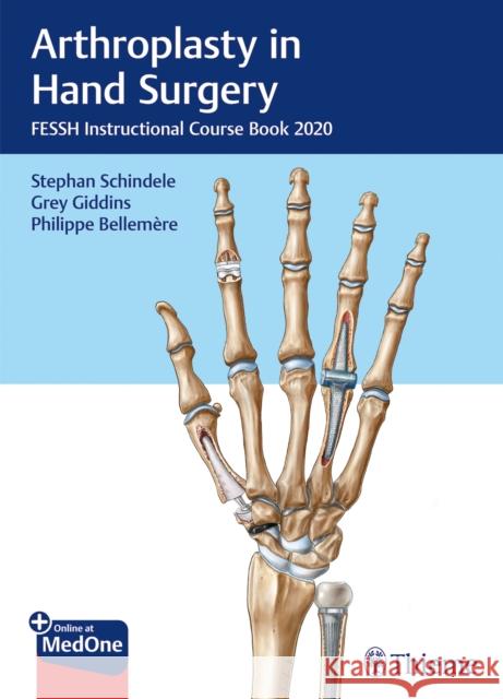 Arthroplasty in Hand Surgery: Fessh Instructional Course Book 2020 Stephan Schindele Grey Giddins Philippe Bellem 9783132431744 Thieme Medical Publishers