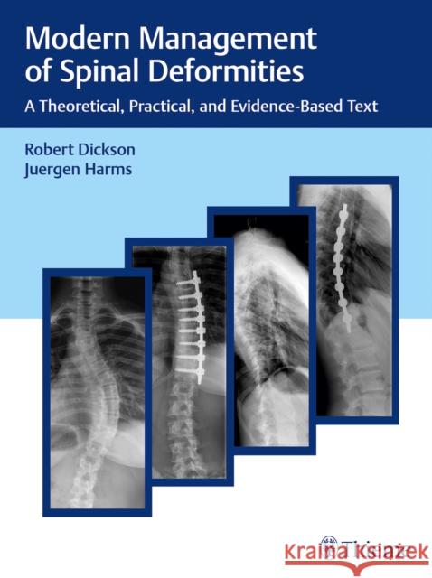 Modern Management of Spinal Deformities: A Theoretical, Practical, and Evidence-Based Text Robert A. Dickson Jurgen Harms  9783132431867