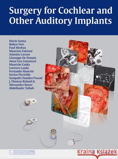 Surgery for Cochlear and Other Auditory Implants Mario Sanna Rolien H. Free Paul Merkus 9783132431904 Thieme Publishing Group