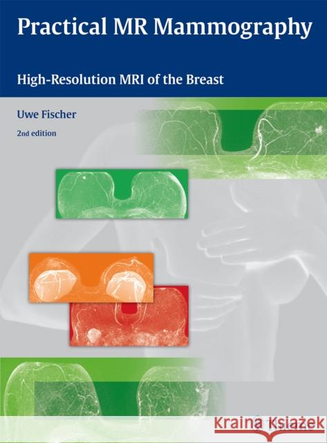 Practical MR Mammography: High-Resolution MRI of the Breast Uwe Fischer   9783132431935 Thieme Publishing Group
