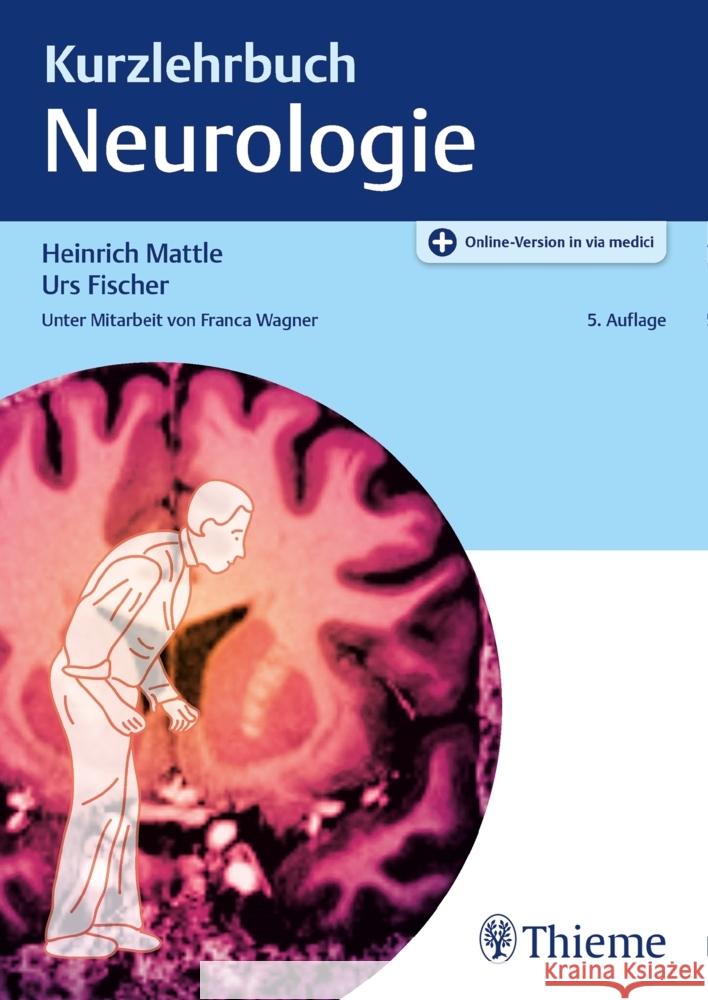 Kurzlehrbuch Neurologie Mattle, Heinrich, Fischer, Urs 9783132434301