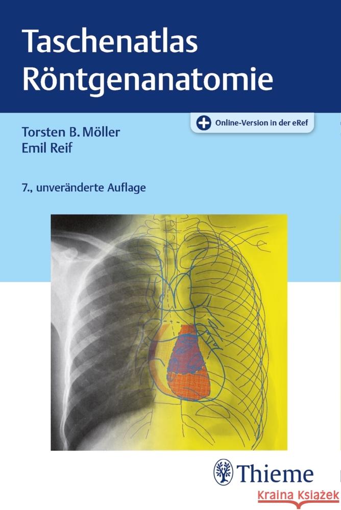 Taschenatlas Röntgenanatomie Möller, Torsten Bert, Reif, Emil 9783132441873