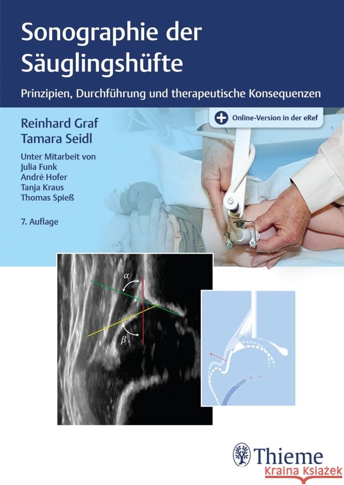 Sonographie der Säuglingshüfte Graf, Reinhard, Seidl, Tamara 9783132443518