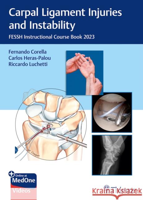 Carpal Ligament Injuries and Instability  9783132451896 Thieme Publishing Group