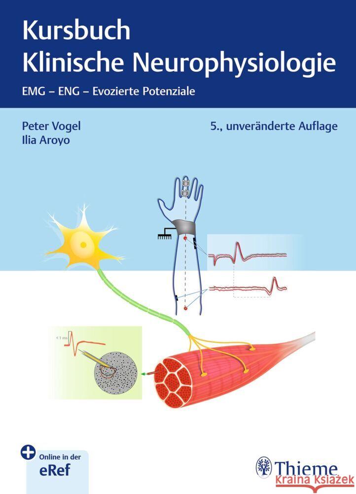 Kursbuch Klinische Neurophysiologie Vogel, Peter, Aroyo, Ilia 9783132456792