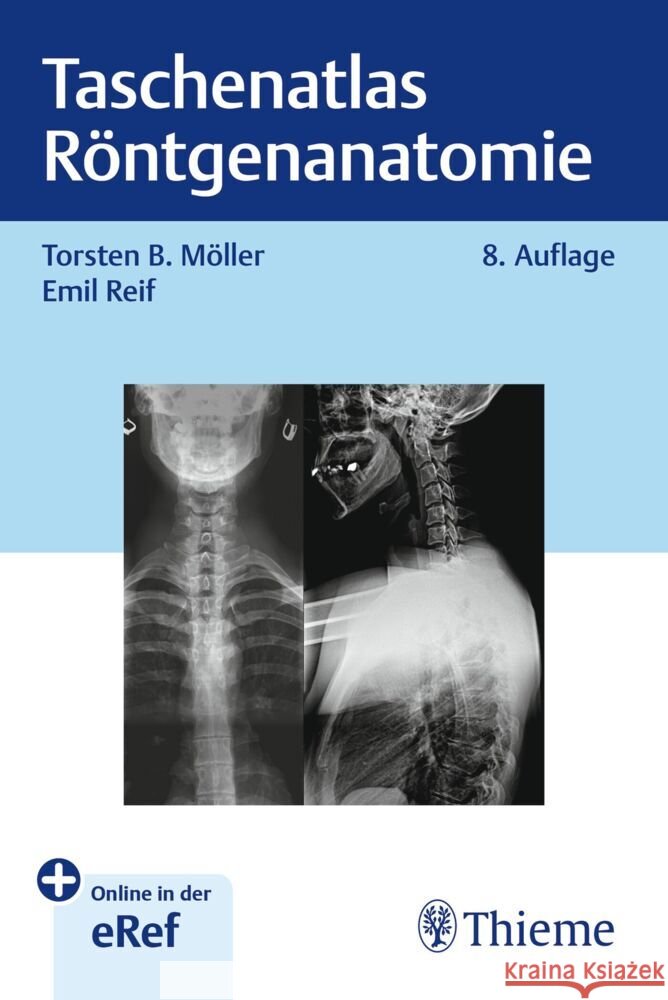 Taschenatlas Röntgenanatomie Möller, Torsten Bert, Reif, Emil 9783132460072