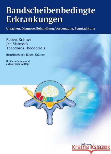 Bandscheibenbedingte Erkrankungen : Ursachen, Diagnose, Behandlung, Vorbeugung, Begutachtung Krämer, Robert; Matussek, Jan; Theodoridis, Theodoros 9783135556062