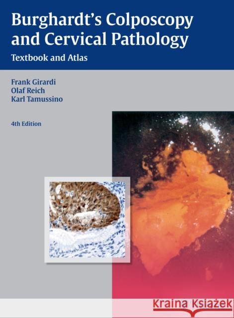 Burghardt's Colposcopy and Cervical Pathology: Textbook and Atlas Girardi, Frank 9783136599044 Thieme Medical Publishers
