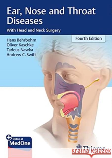 Ear, Nose, and Throat Diseases: With Head and Neck Surgery Andrew C. Swift 9783136712047