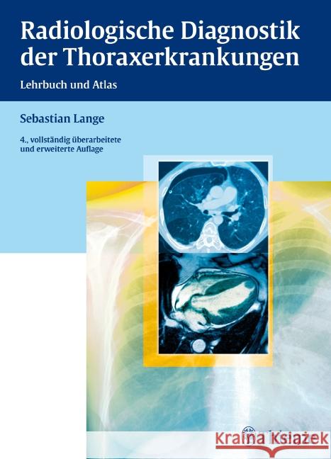 Radiologische Diagnostik der Thoraxerkrankungen : Lehrbuch und Atlas Lange, Sebastian Montag, Michael  9783136893043