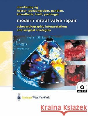 Modern Mitral Valve Repair : Echocardiographic Interpretations and Surgical Strategies Choi-Keung Ng 9783211008607 