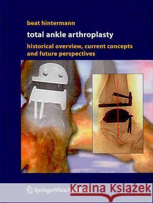 Total Ankle Arthroplasty: Historical Overview, Current Concepts and Future Perspectives Beat Hintermann 9783211212523