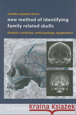 New Method of Identifying Family Related Skulls: Forensic Medicine, Anthropology, Epigenetics Zupanic Slavec, Zvonka 9783211220443 Springer