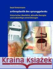 Endoprothetik des Sprunggelenks: Historischer Überblick, aktuelle Therapiekonzepte und Entwicklungen Beat Hintermann 9783211235867 Springer Verlag GmbH