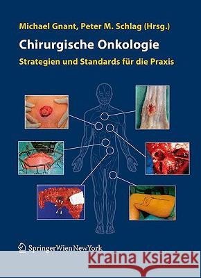 Chirurgische Onkologie: Strategien Und Standards Für Die Praxis Gnant, Michael 9783211486122 Springer, Wien