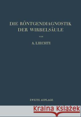 Die Röntgendiagnostik Der Wirbelsäule Und Ihre Grundlagen Eggli, A. 9783211800591 Springer