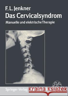 Das Cervicalsyndrom: Manuelle Und Elektrische Therapie Jenkner, F. L. 9783211817087 Springer