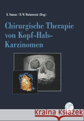 Chirurgische Therapie Von Kopf-Hals-Karzinomen Kurt Vinzenz Hans W. Waclawiczek 9783211822067