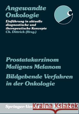 Prostatakarzinom Malignes Melanom Bildgebende Verfahren in Der Onkologie P. Barton P. Fritsch N. Gritzmann 9783211822289 Springer