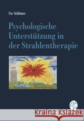 Psychologische Unterstützung in Der Strahlentherapie Schlömer, Ute 9783211825464 Springer
