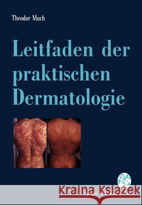 Leitfaden Der Praktischen Dermatologie: Lokale Und Systemische Therapie - Mit Diagnosehinweisen - Much, Theodor 9783211825556 Springer