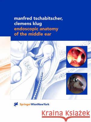 Endoscopic Anatomy of the Middle Ear Manfred Tschabitscher Clemens Klug M. Tschabitscher 9783211829738 Springer Vienna