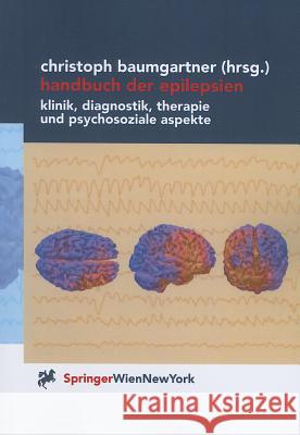 Handbuch der Epilepsien: Klinik, Diagnostik, Therapie Und Psychosoziale Aspekte Baumgartner, Christoph 9783211835753 Springer, Wien