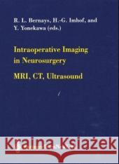 Intraoperative Imaging in Neurosurgery: Mri, Ct, Ultrasound Bernays, R. L. 9783211838358 Springer Vienna